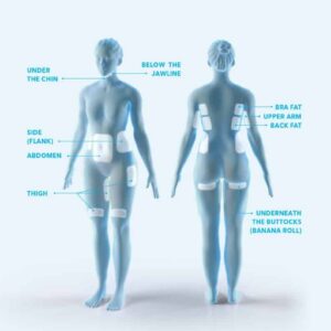 Krüolipolüüsi piirkonnad