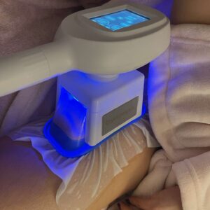 Krüolipolüüs rasvade külmutamine